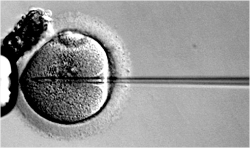 난자 내로 정자를 주입하는 ‘세포질 내 정자주입술’ 장면. 시험관 아기 시술법 중 하나.